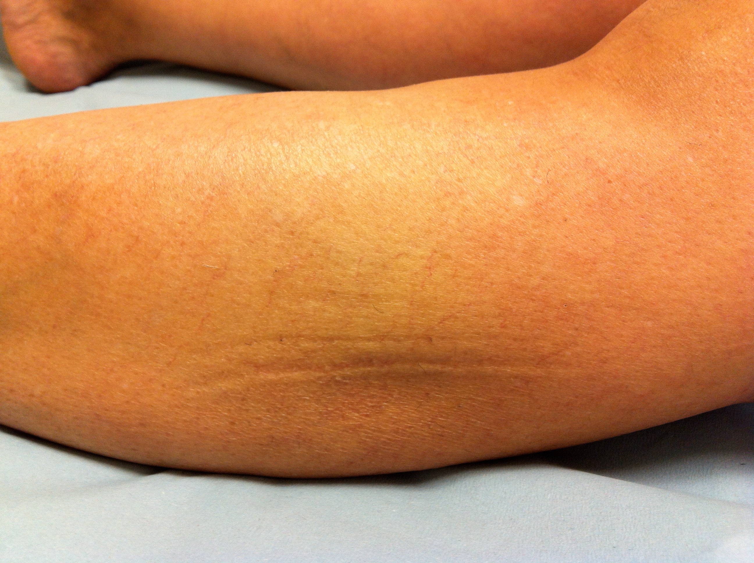 Clinica Ana Jimenez - resive despues 1